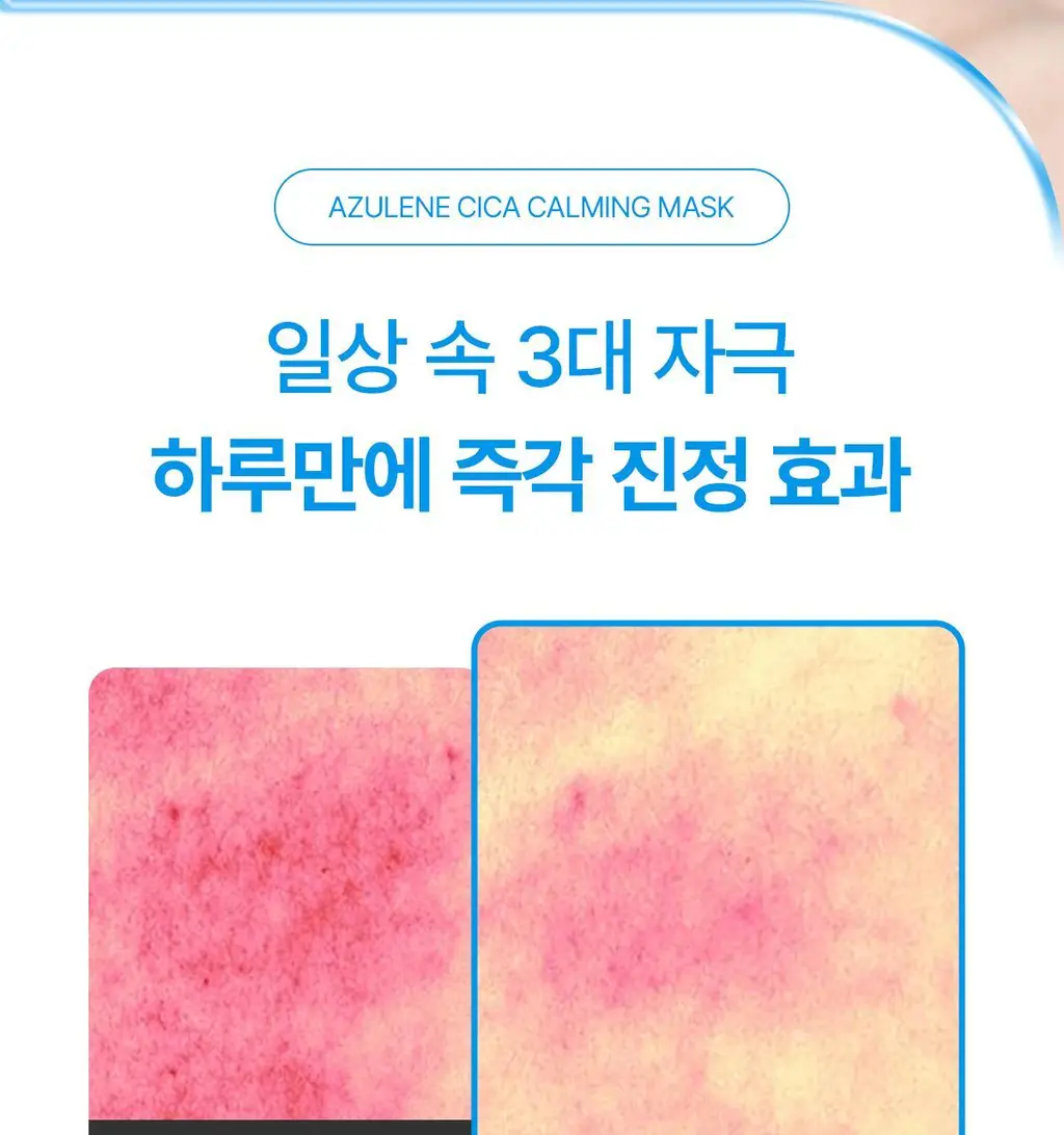 [조권 PICK] 프롬메디 아줄렌 시카 카밍 마스크 [1매/4매] 상세페이지 6